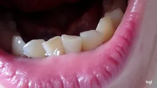 20 minutes of my down teeth to cam