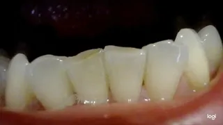 50 minutes of my teeth to cam no sound