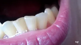 5 minutes of my teeth down side in close up