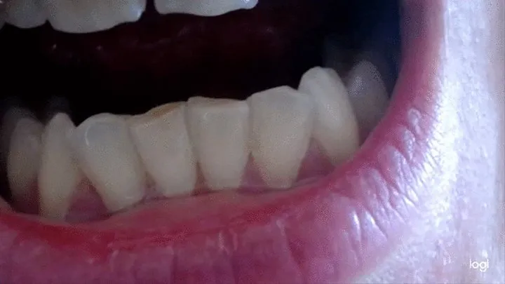 13 minutes of down side teeth to cam