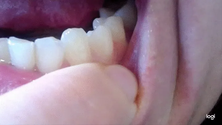 10 minutes teeth to cam no sound no audio