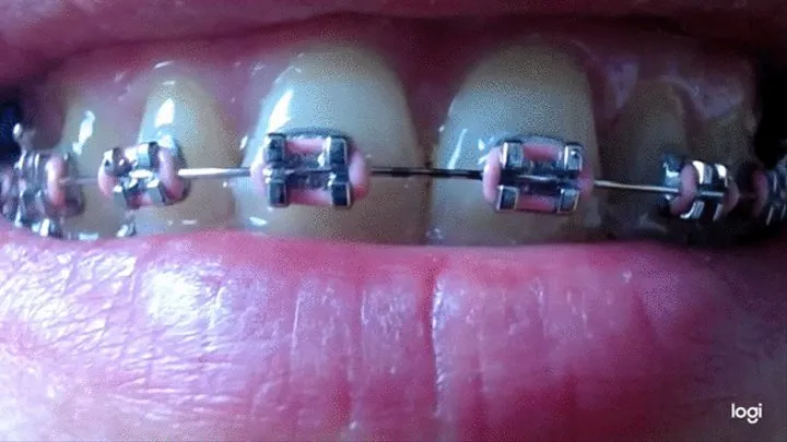 4 minutes teeth to cam with brazes on