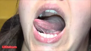 Inside my mouth [LINDA]