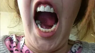 Close up Black and Yellow Nasty Smoker's Teeth - Rotten Broken Teeth - Cavities and Fillings