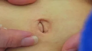 Belly Button Innie To Outie Closeup