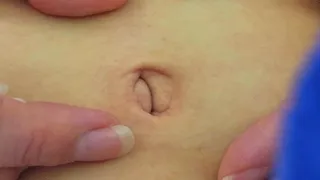 Belly Button Innie To Outie Closeup