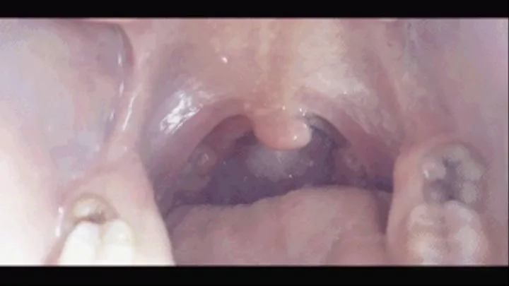 Teeth and Uvula Up Close (Custom Request)