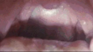 Uvula Close Yawning (Custom Request)