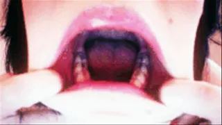 Teeth Uvula Tongue Stretch