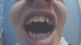 White tooth sexy too