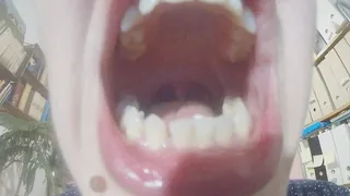 Teeth smashed jelly's bear neck