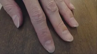 Fingernails