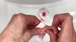 Manicure Removal
