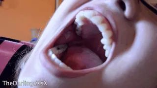 One Big Yawn - 3 min
