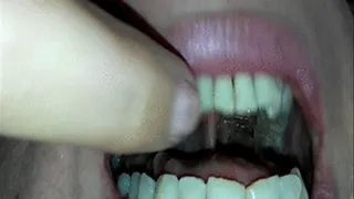 Mouth Teeth Tour of My Friend 94