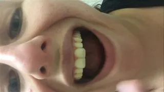 Mouth Teeth Tour of My Friend 2