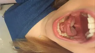 Mouth Teeth Tour of My Friend 16