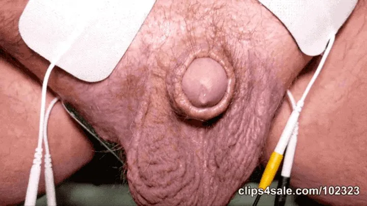 - My patient uses a male masturbation device