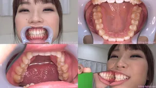 Tsubasa Hachino - Watching Inside mouth of Japanese beautiful girl BITE-111-1
