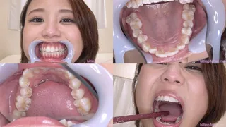 Mitsuki Aya - Watching Inside mouth of Japanese cute girl BITE-115-1