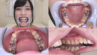 Riona Suzushiro - Watching Inside mouth of Japanese cute girl BITE-113-1