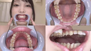 Nao Kiritani - Watching Inside mouth of Japanese cute girl BITE-105-1