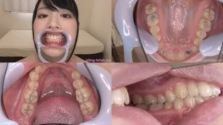 Yukina Shida - Watching Inside mouth of Japanese cute girl BITE-109-1