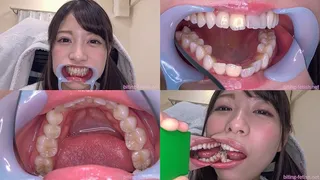 Rena Aoi - Watching Inside mouth of Japanese cute girl BITE-93-1