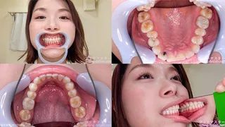 Tsubaki - Watching Inside mouth of Japanese cute girl bite-149-1