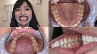 Arisa - Watching Inside mouth of Japanese cute girl bite-138-1