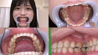 Kanon - Watching Inside mouth of Japanese cute girl bite-147-1