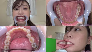 Yurica - Watching Inside mouth of Japanese cute girl bite-128-1