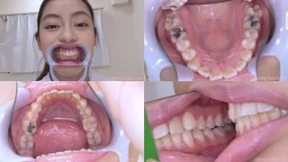 Hikari - Watching Inside mouth of Japanese cute girl bite-129-1