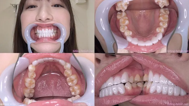 Haruna - Watching Inside mouth of Japanese cute girl bite-134-1