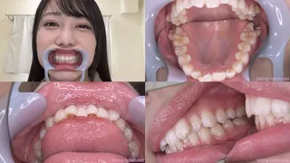 Mizuki Yayoi - Watching Inside mouth of Japanese cute girl BITE-119-1
