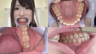 Honoka Tsujii - Watching Inside mouth of Japanese cute girl BITE-121-1