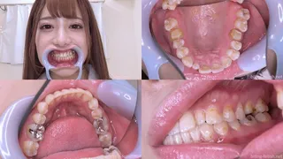 Nozomi - Watching Inside mouth of Japanese cute girl bite-127-1
