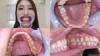 Toka - Watching Inside mouth of Japanese cute girl BITE-125-1