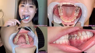 Meirin - Watching Inside mouth of Asian pretty girl BITE-54-1