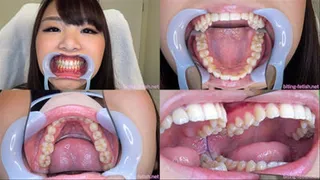 Kurumi - Watching Inside mouth of Japanese pretty girl BITE-45-1