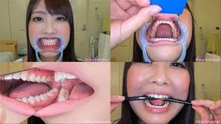 Nonoka - Watching Inside mouth of Japanese enchanting girl BITE-52-1