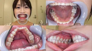 Nozomi - Watching Inside mouth of Japanese pretty lady BITE-41-1