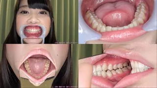 Aya - Watching Inside mouth of Japanese cute girl
