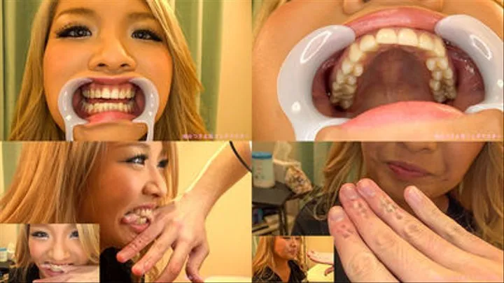 Natsuki - Watching Inside mouth of Japanese cute gyaru and bitten fingers by her