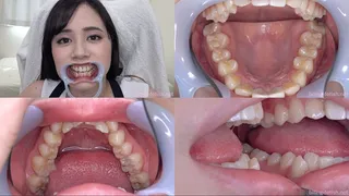 Aimi Yoshikawa - Watching Inside mouth of Japanese pretty girl BITE-77-1