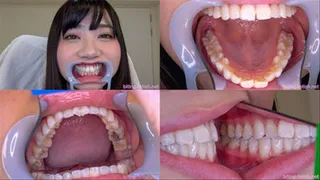 Ren Ichinose - Watching Inside mouth of Japanese pretty girl BITE-65-1