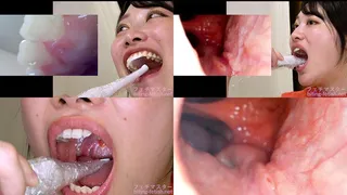 Miki Sunohara - Observing Sunohara Miki's teeth, mouth, and back of the throat with a dental camera