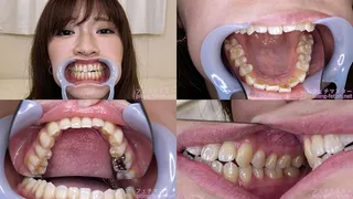 Sara - Watching Inside mouth of Japanese cute girl bite-222-1