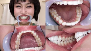 Tomoka - Watching Inside mouth of Japanese cute girl bite-232-1