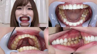 Maria - Watching Inside mouth of Japanese cute girl bite-216-1